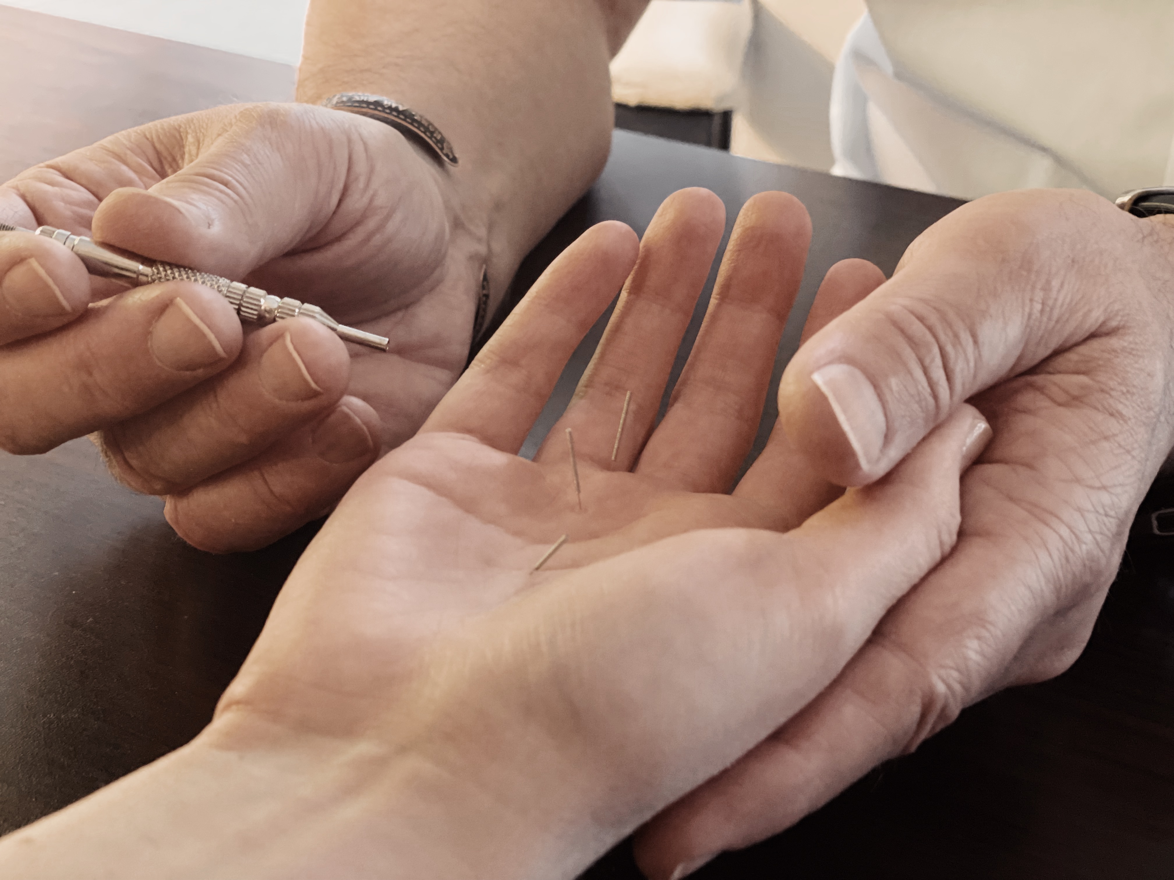 Су-джок терапия